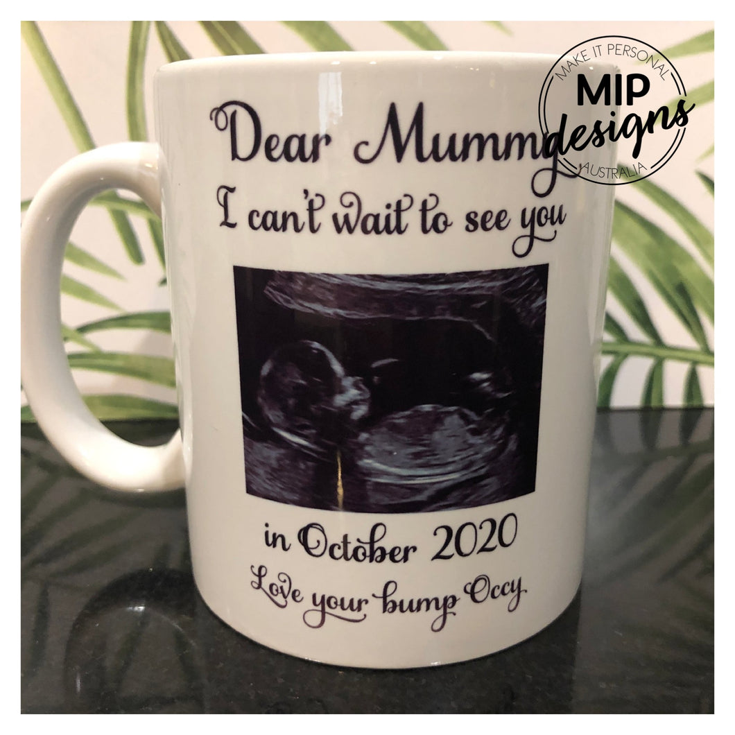 Mugs - Ultrasound